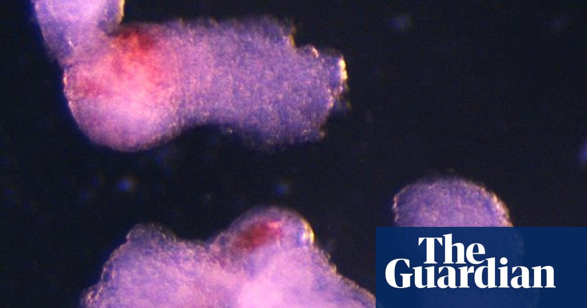 The ability to generate blood stem cells in the laboratory could make it possible to treat patients in need of bone marrow transplants using their own cells.