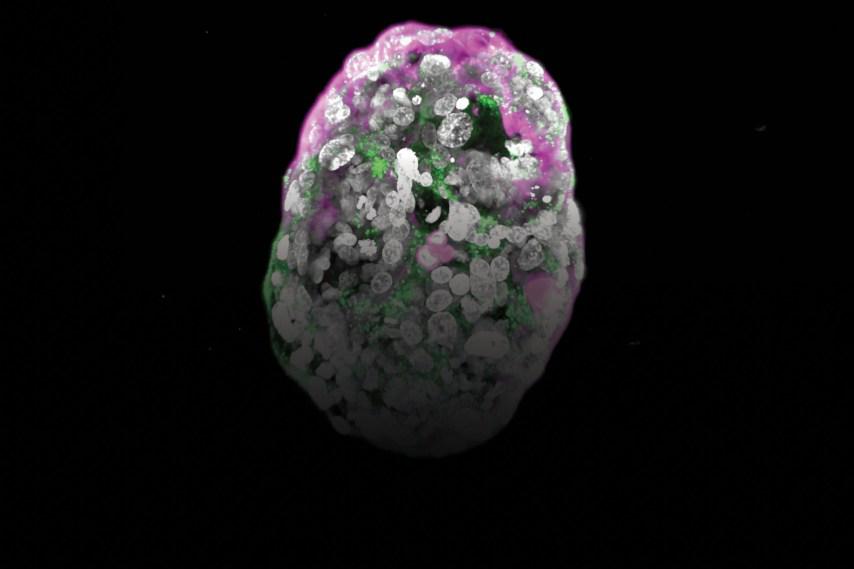 The astonishing embryo models of Jacob Hanna