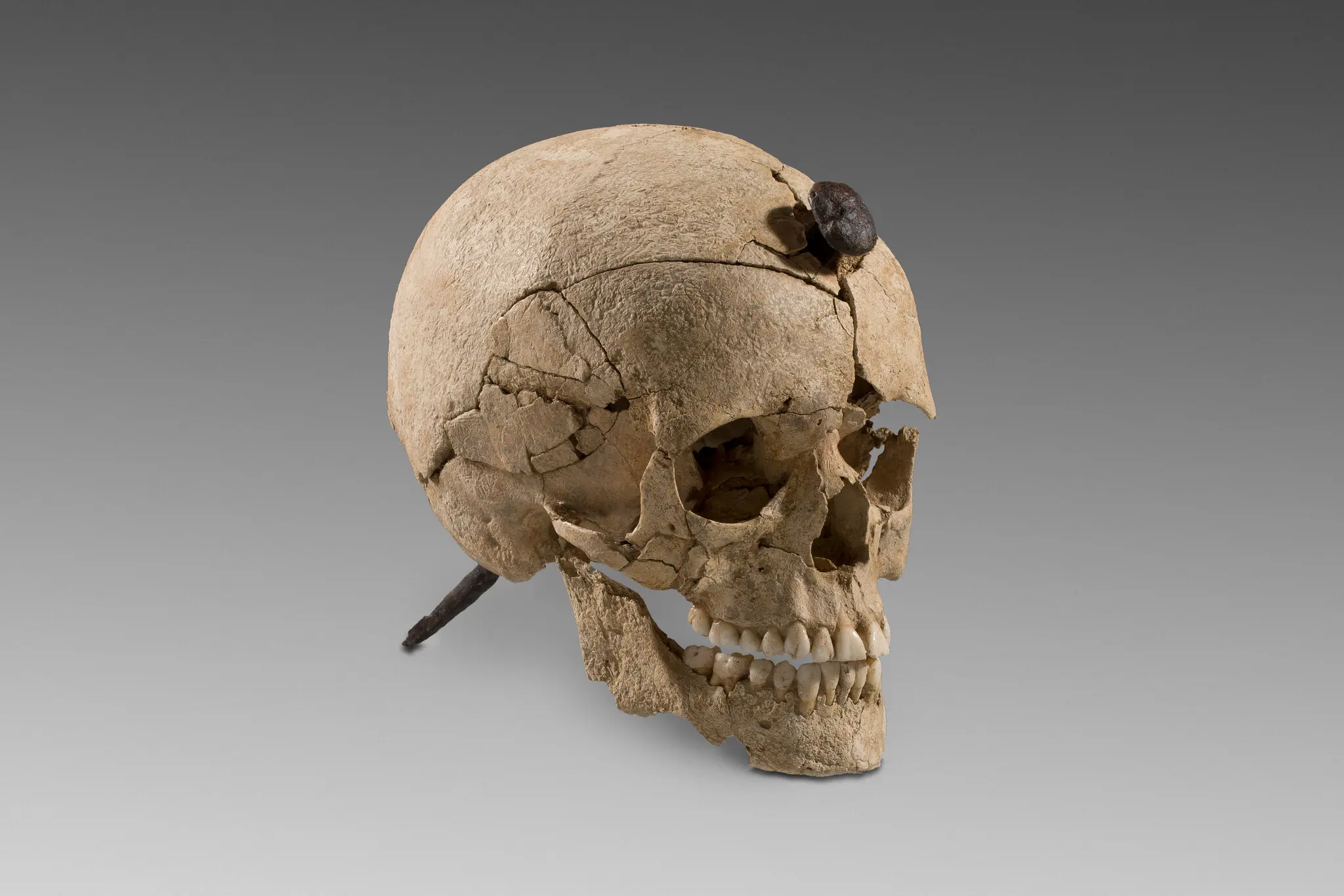 One of several severed heads with nails through them found at Ullastret, a settlement site in northern Spain dating from the Iron Age.