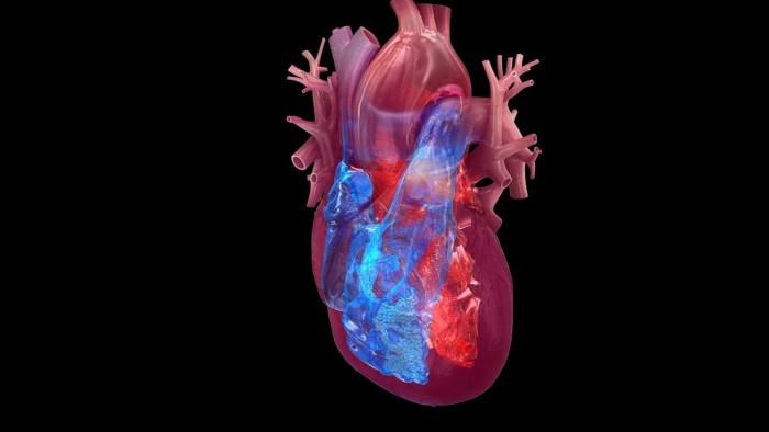 Apple Watch data teamed with AI reveals heart damage