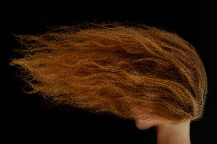 With tens of millions of redheads sprinkled throughout the global population, this exotic trait isn't disappearing. 