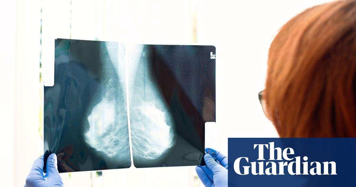 More than 2 million people globally each year are diagnosed with breast cancer.